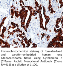 Cytokeratin 7 (C-Term) Rabbit Monoclonal Antibody (Clone RM416)