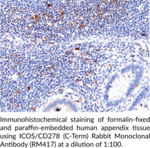 ICOS/CD278 (C-Term) Rabbit Monoclonal Antibody (RM417) (Activation-inducible Lymphocyte Immunomediatory Molecule, Inducible T cell Co-Stimulator)