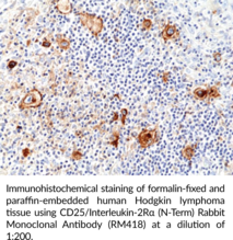 CD25/Interleukin-2Rα (N-Term) Rabbit Monoclonal Antibody (RM418) (CD25/IL-2Rα, Cluster of Differentiation 25/Interleukin-2 Receptor Subunit α, ILR2A)