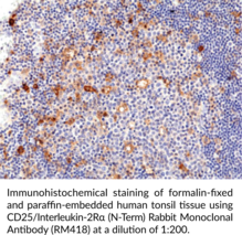 CD25/Interleukin-2Rα (N-Term) Rabbit Monoclonal Antibody (RM418)
