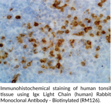 Igκ Light Chain (human) Rabbit Monoclonal Antibody - Biotinylated (RM126) (Igκ, Immunoglobulin κ Light Chain)