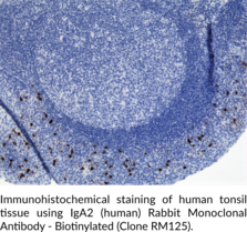 IgA2 (human) Rabbit Monoclonal Antibody - Biotinylated (Clone RM125) (Immunoglobulin A2)