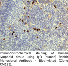 IgD (human) Rabbit Monoclonal Antibody - Biotinylated (Clone RM123)