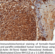 β-Actin (N-Term) Rabbit Monoclonal Antibody - Biotinylated (Clone RM112)
