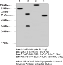SARS-CoV-2 Spike Glycoprotein S1 Subunit Polyclonal Antibody (COVID-19 Surface Glycoprotein S1 Subunit, 2019-nCoV Surface Glycoprotein S1 Subunit, SARS-CoV-2 Surface Glycoprotein S1 Subunit, Severe Acute Respiratory Syndrome Coronavirus 2 Spike Glycoprotein S1 Subunit)