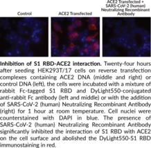 SARS-CoV-2 (human) Neutralizing Recombinant Antibody