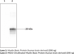 Citrullinated Myelin Basic Protein (R122) Monoclonal Antibody (Clone 1H1) (citMBP, Citrullinated Myelin A1 Protein, Citrullinated Myelin Membrane Encephalitogenic Protein, Myelin A1 Protein, Myelin Membrane Encephalitogenic Protein)