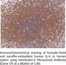 Interleukin-6 Monoclonal Antibody (Clone 19)