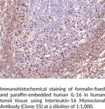 Interleukin-16 Monoclonal Antibody (Clone 55) (IL-16, LCF)