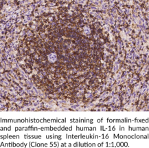Interleukin-16 Monoclonal Antibody (Clone 55)
