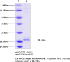 Calcineurin B (human, recombinant) (Calcineurin Subunit B Type 1, CALNB1, CNA2, CNB, CNB1, PPP3R1, Protein Phosphatase 2B Regulatory Subunit 1, Protein Phosphatase 3 Regulatory Subunit B α Isoform 1)