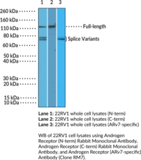 Androgen Receptor (C-Term) Rabbit Monoclonal Antibody (Clone RM255) (AR, NR3C4, Nuclear Receptor Subfamily 3 Group C Member 4)