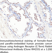 Androgen Receptor (C-Term) Rabbit Monoclonal Antibody (Clone RM255)