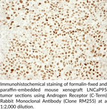 Androgen Receptor (C-Term) Rabbit Monoclonal Antibody (Clone RM255)