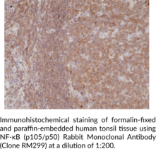 NF-κB (p105/p50) Rabbit Monoclonal Antibody (Clone RM299)