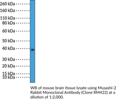 Musashi-2 Rabbit Monoclonal Antibody (Clone RM422) (MSI2, RNA-Binding Protein Musashi Homolog 2)