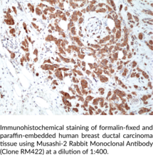 Musashi-2 Rabbit Monoclonal Antibody (Clone RM422)