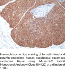 Musashi-2 Rabbit Monoclonal Antibody (Clone RM422)