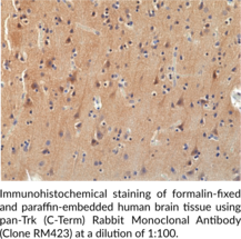 pan-Trk (C-Term) Rabbit Monoclonal Antibody (Clone RM423)