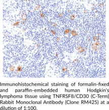 TNFRSF8/CD30 (C-Term) Rabbit Monoclonal Antibody (Clone RM425)