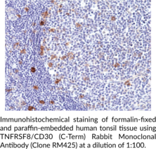 TNFRSF8/CD30 (C-Term) Rabbit Monoclonal Antibody (Clone RM425)