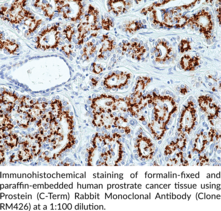 Prostein (C-Term) Rabbit Monoclonal Antibody (Clone RM426) (p501s, PCANAP6, Prostate Cancer-associated Protein 6)