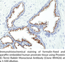 Prostein (C-Term) Rabbit Monoclonal Antibody (Clone RM426)