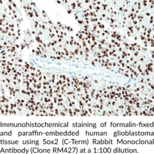 Sox2 (C-Term) Rabbit Monoclonal Antibody (Clone RM427)