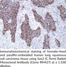 Sox2 (C-Term) Rabbit Monoclonal Antibody (Clone RM427)