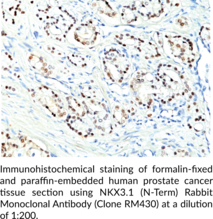 NKX3.1 (N-Term) Rabbit Monoclonal Antibody (Clone RM430) (Homeobox Protein Nkx-3.1, NK3 Homeobox 1, NKX3A)