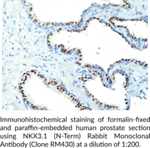 NKX3.1 (N-Term) Rabbit Monoclonal Antibody (Clone RM430)