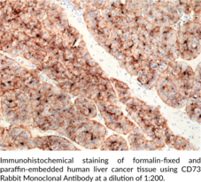 Ecto-5’-nucleotidase/CD73 Rabbit Monoclonal Antibody (Clone RM431)