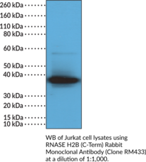 RNase H2B (C-Term) Rabbit Monoclonal Antibody (Clone RM433) (Aicardi-Goutieres Syndrome 2 Protein, Deleted in Lymphocytic Leukemia 8, DLEU8, Ribonuclease H2 Subunit B)