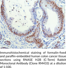 RNase H2B (C-Term) Rabbit Monoclonal Antibody (Clone RM433)