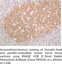 RNase H2B (C-Term) Rabbit Monoclonal Antibody (Clone RM433)