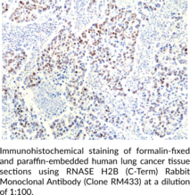 RNase H2B (C-Term) Rabbit Monoclonal Antibody (Clone RM433)