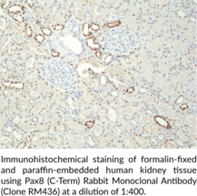 Pax8 (C-Term) Rabbit Monoclonal Antibody (Clone RM436) (Paired Box Protein 8)