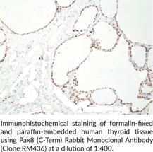 Pax8 (C-Term) Rabbit Monoclonal Antibody (Clone RM436)