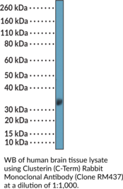 Clusterin (C-Term) Rabbit Monoclonal Antibody (Clone RM437) (Apolipoprotein J, ApoJ, Ku70-binding Protein 1, SGP-2, Sulfated Glycoprotein 2, Testosterone-repressed Prostate Message 2, TRPM-2)
