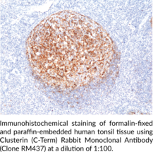 Clusterin (C-Term) Rabbit Monoclonal Antibody (Clone RM437)