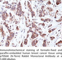 p70S6K (N-Term) Rabbit Monoclonal Antibody (Clone RM438)