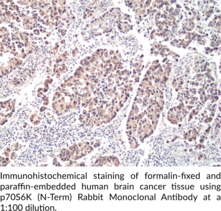 p70S6K (N-Term) Rabbit Monoclonal Antibody (Clone RM438)