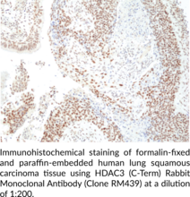 HDAC3 (C-Term) Rabbit Monoclonal Antibody (Clone RM439)