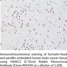 HDAC3 (C-Term) Rabbit Monoclonal Antibody (Clone RM439)