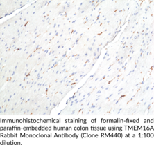 TMEM16A Rabbit Monoclonal Antibody (Clone RM440)