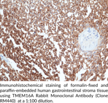 TMEM16A Rabbit Monoclonal Antibody (Clone RM440)