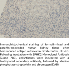 Sphingosine Kinase 2 Monoclonal Antibody (Clone 7B3)