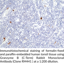 Granzyme B (C-Term) Rabbit Monoclonal Antibody (Clone RM441) (CTLA-1, Cytotoxic Serine Protease B, Cytotoxic T-lymphocyte Proteinase 2, Fragmentin-2, Granzyme-2, GrB, GZMB)
