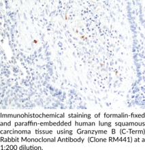 Granzyme B (C-Term) Rabbit Monoclonal Antibody (Clone RM441)