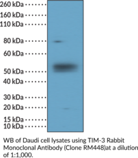 TIM-3 Rabbit Monoclonal Antibody (Clone RM448) (CD366, Hepatitis A Virus Cellular Receptor 2 Precursor, KIM-3, T Cell Immunoglobulin and Mucin Domain-containing Protein 3, T Cell Immunoglobulin Mucin Receptor 3, T Cell Membrane Protein 3, TIMD-3)